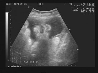 животик 36 неделя беременности