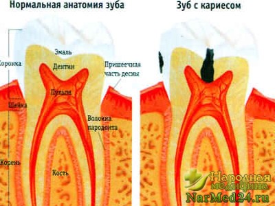 Причины зубной боли 