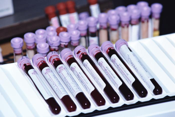 Расшифровка общего анализа крови