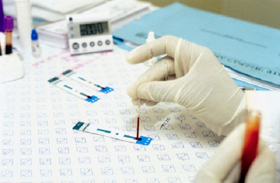 Как правильно сдать анализ крови на ХГЧ при беременности