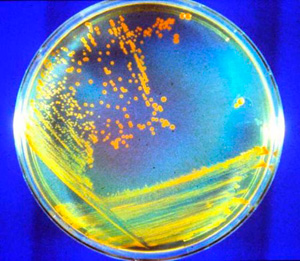 Размножение бактерий в полости рта человека
