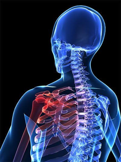 Болевые ощущения в плече могут быть вызваны многими заболеваниями