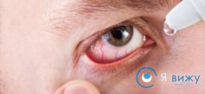 При красных сосудах в белках глаз нужно лечить основное заболевание