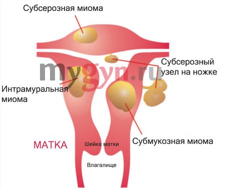 Разные виды миом