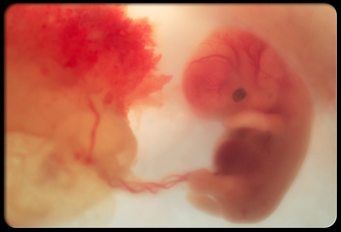 Эмбрион на 8 неделе беременности и его развитие
