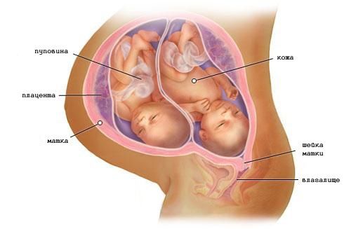 Беременность двойней на 35 неделе (фото)