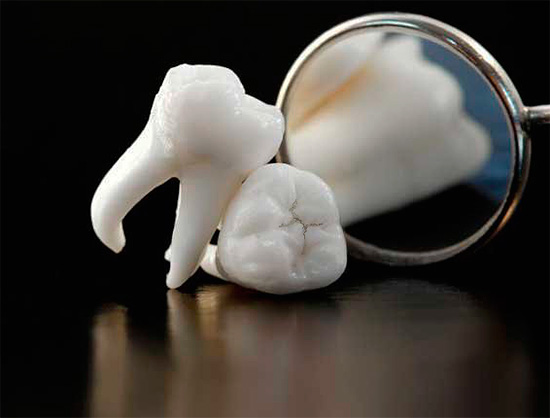 Согласно Осеннему соннику, вырывание зубов может предвещать предстояющую физическую боль в реальной жизни.